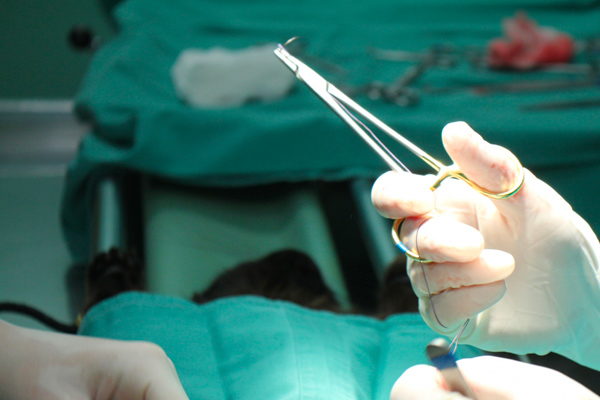 Castration par endochirurgie